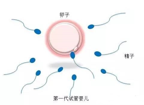 包生男孩试管机构